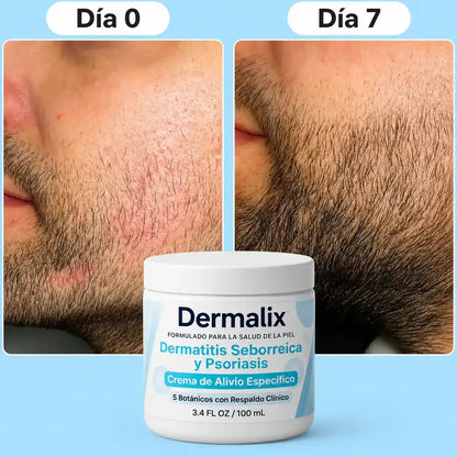Crema Reparadora para Barba™
